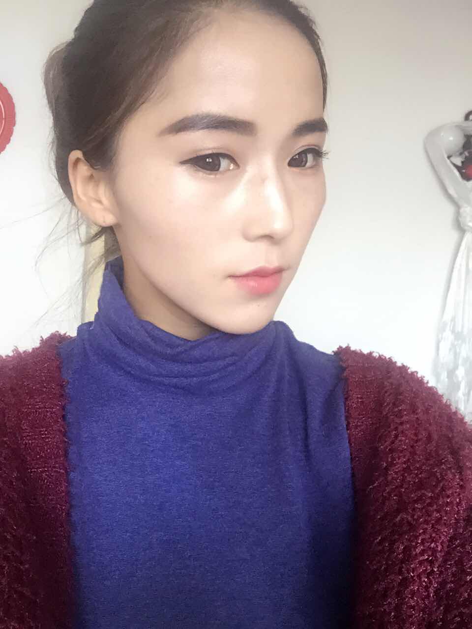 颧弓突出怎么办,请专家看看、我是属于什么脸型、还有我需要整哪里?