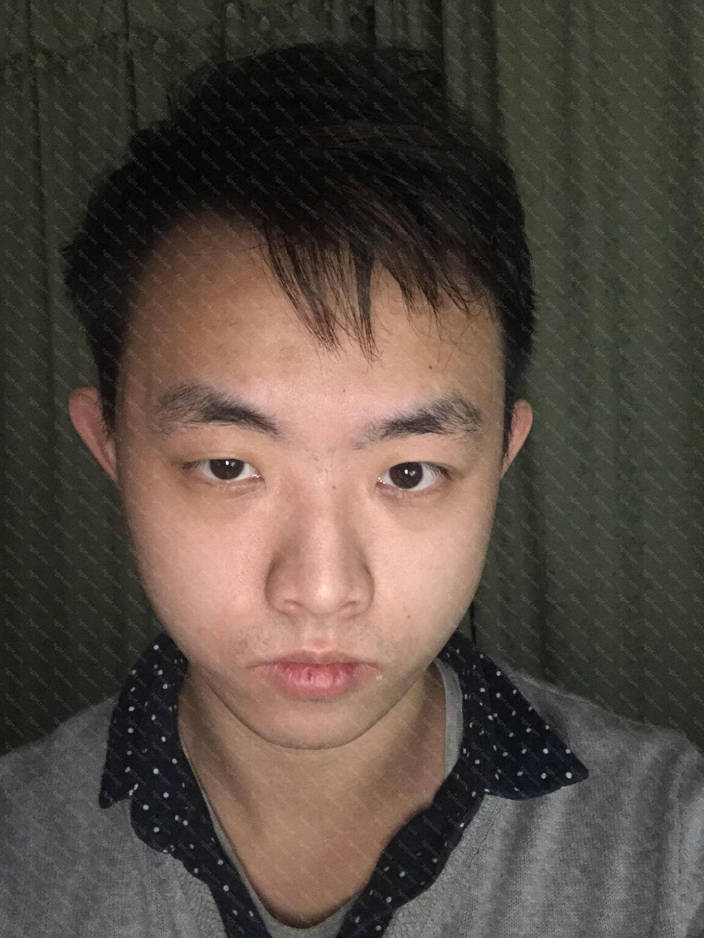露鼻孔怎么办 希望大神帮忙p下鼻子不想漏孔 假体隆鼻模拟 整形模拟 整容通 露鼻孔怎么办 希望大神帮忙p下鼻子不想漏孔 假体隆鼻模拟 整形模拟 整容通