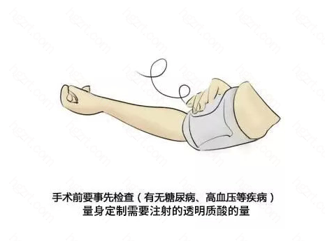 玻尿酸注射是一种快速的非手术治疗手段