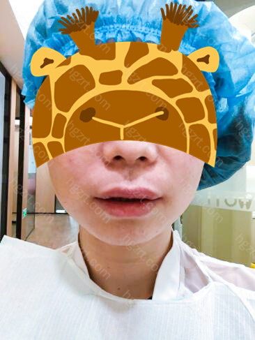 杰美种植体在品质方面的表现非常令种植牙医生和患者满意的