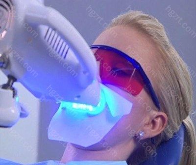 冷光美白的技术是来自于欧美的牙齿美白方式