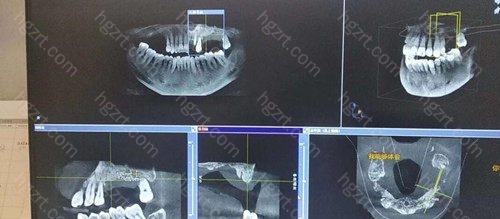 可以满足患者的一切需求 可以满足患者的一切需求