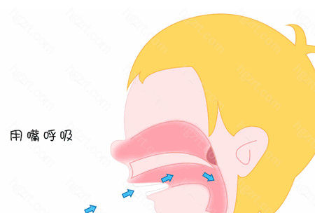 口呼吸不仅会导致面部变丑