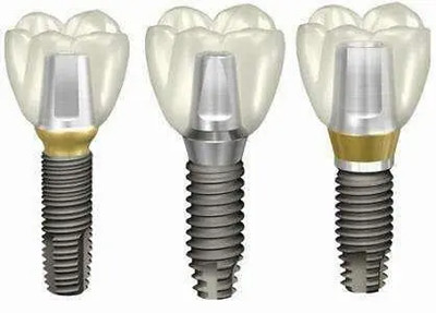 美国3I种植体价格