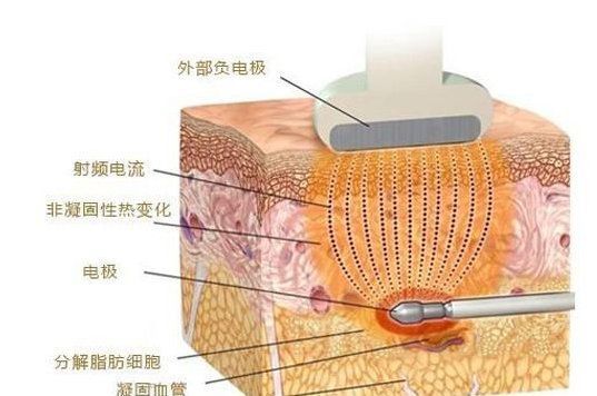 黄金微雕亲身经历:北京做黄金微雕好的医院和医生在哪里?