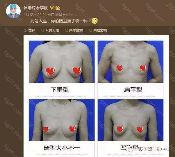 扁平胸怎么办 整容通